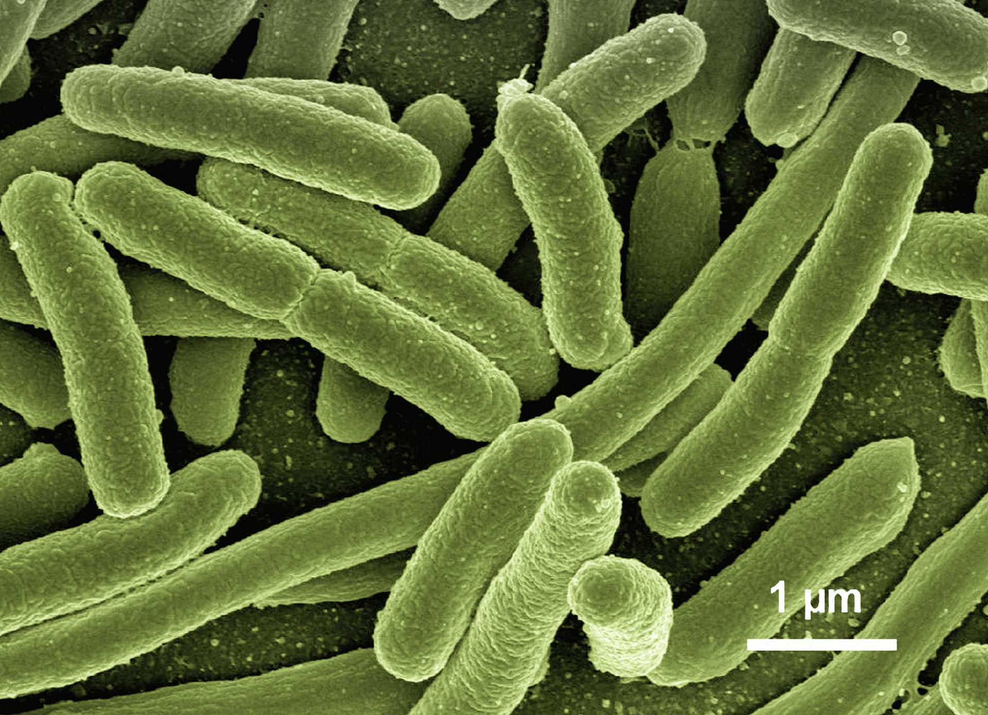 Bactéries Escherichia coli  © Gerd Altmann / Pixabay / Étincel www.reseau-canope.fr/etincel
